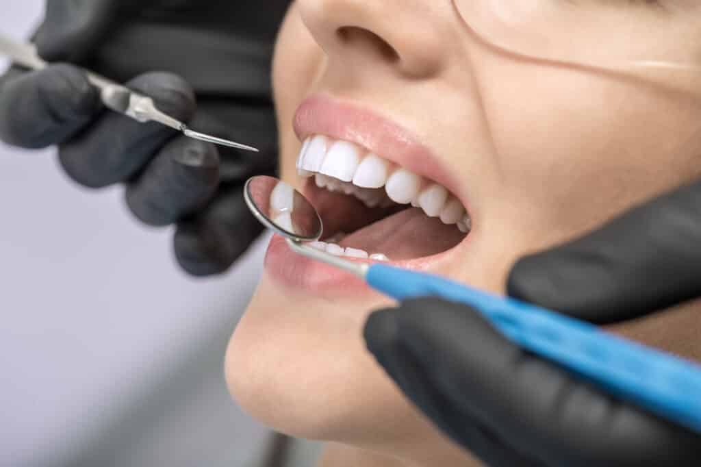 איך לתקן כתר זירקוניה בשיניים